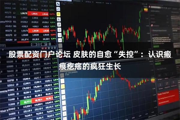 股票配资门户论坛 皮肤的自愈“失控”：认识瘢痕疙瘩的疯狂生长